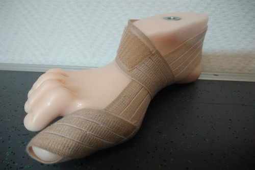 Aktive Behandlung des Hallux valgus